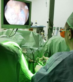 El láser verde convierte en vapor de agua la zona de tejido prostático adenomatoso en la que actúa. / ABC/