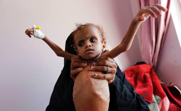 Denuncian que unos 85.000 niños podrían haber muerto de hambre en Yemen  desde 2015 | La Rioja